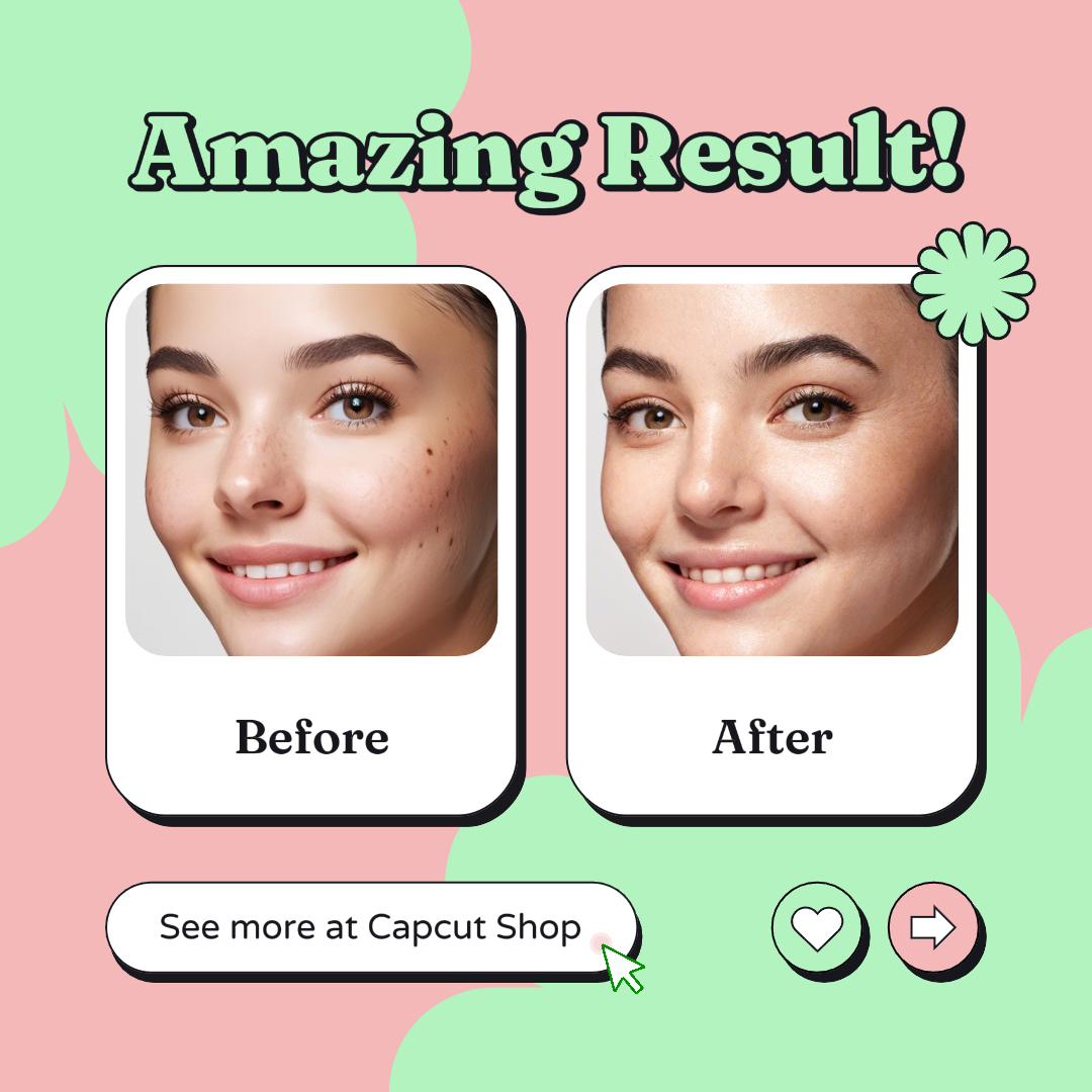 Póster de marketing para el cuidado de la belleza antes y después Resultado llamativo rosa y verde