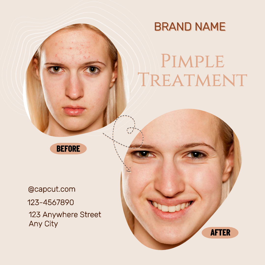 Marketing Poster Instagram post Antes e depois