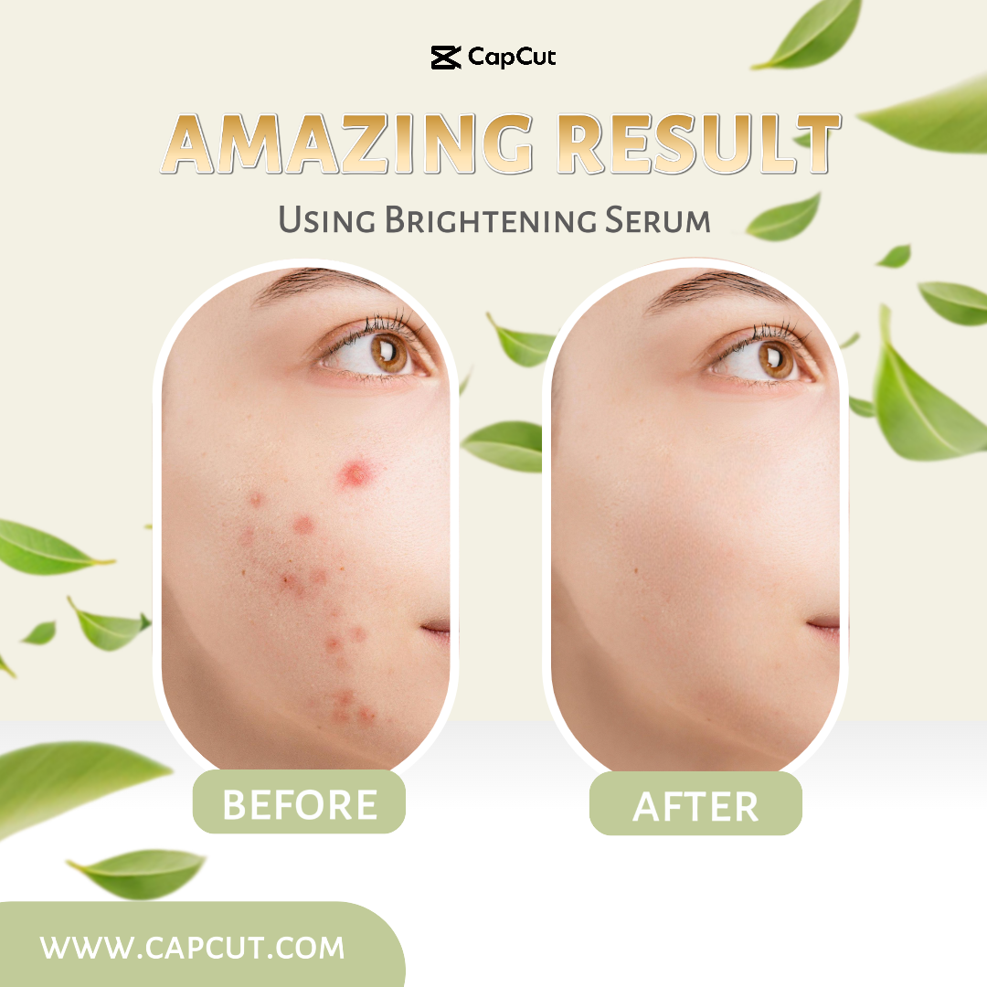 Cuidados de beleza antes depois dos cuidados com a pele Instagram Post