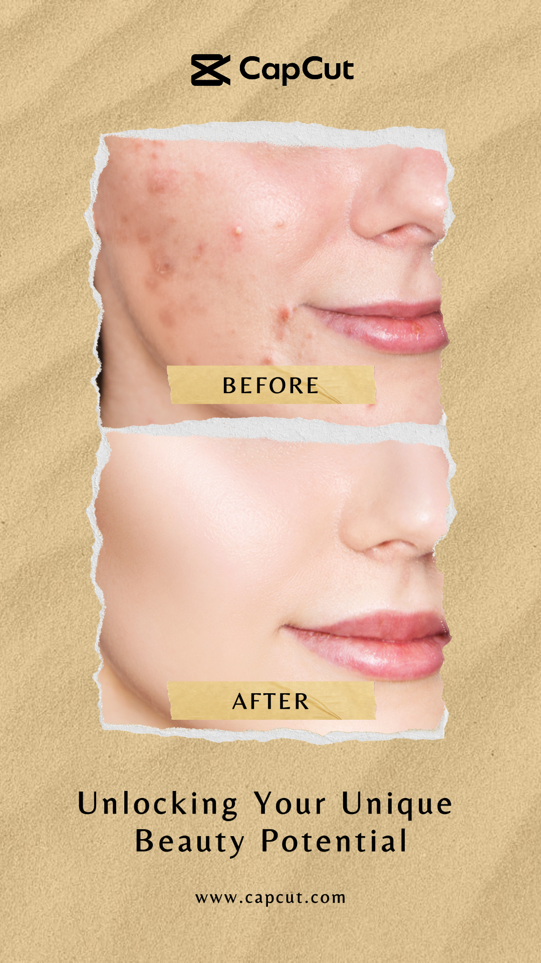 Marketing Poster Beauty Care Before & After Beauty Instagram Story