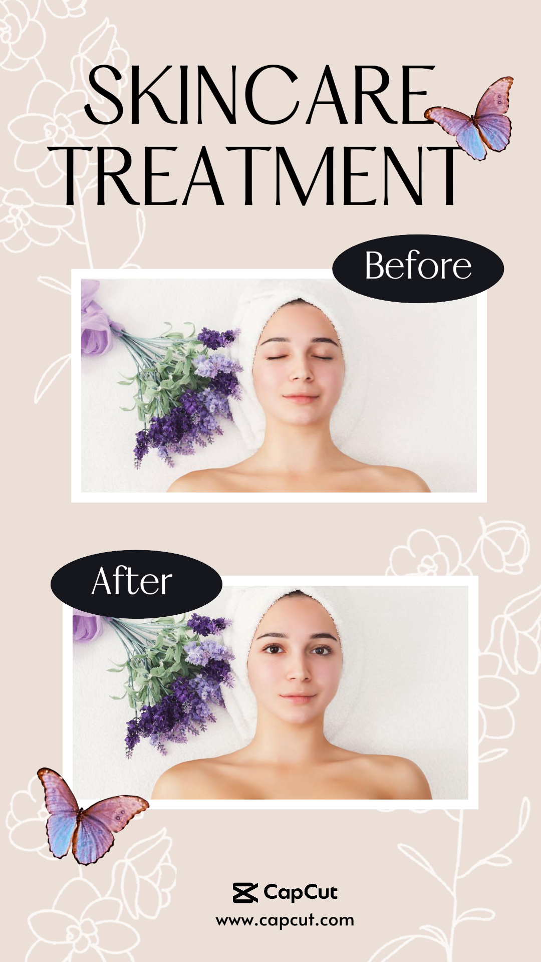 capcut template cover