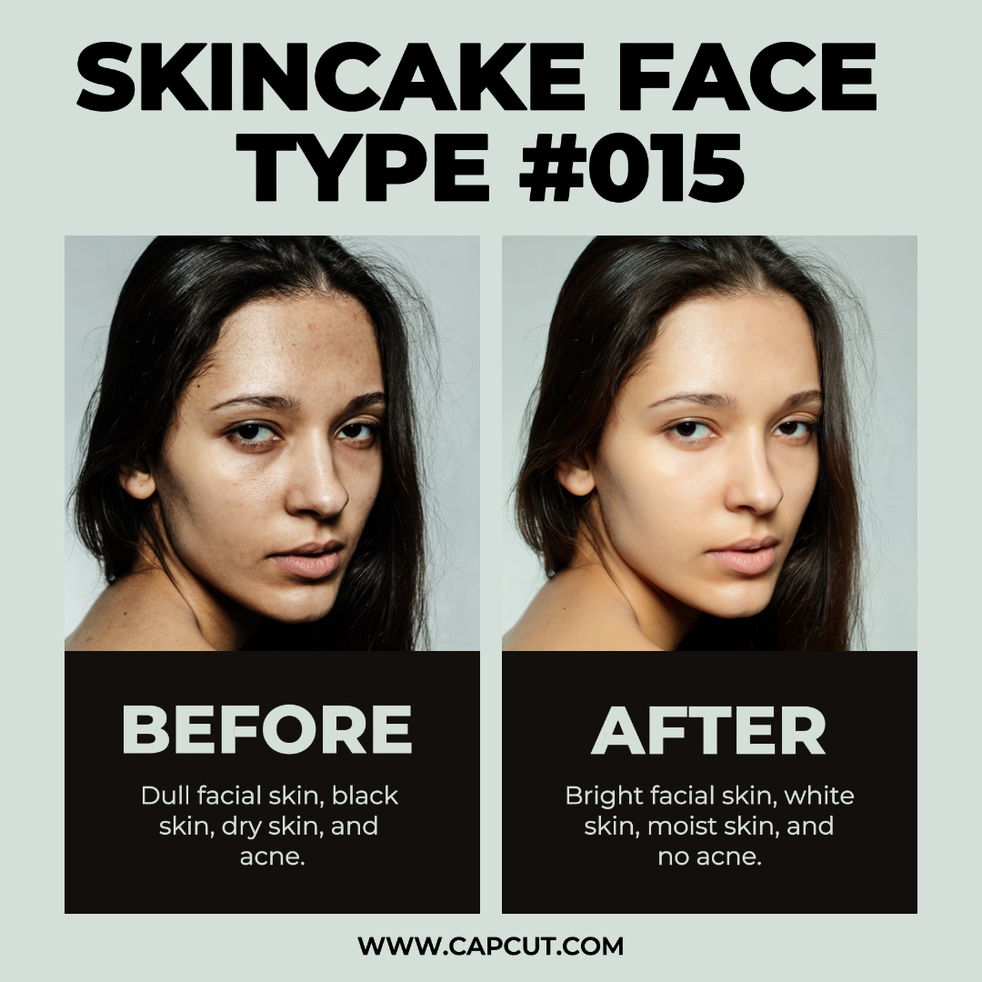 Putih Hitam Minimalis Modern Sebelum Setelah Tampilan Produk Skincake Posting Instagram