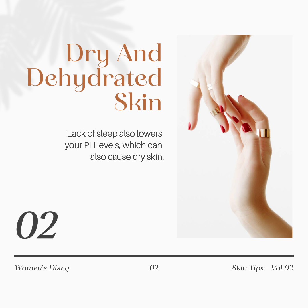 Consejos Elegantes Para El Cuidado De La Piel Carrusel Instagram Post